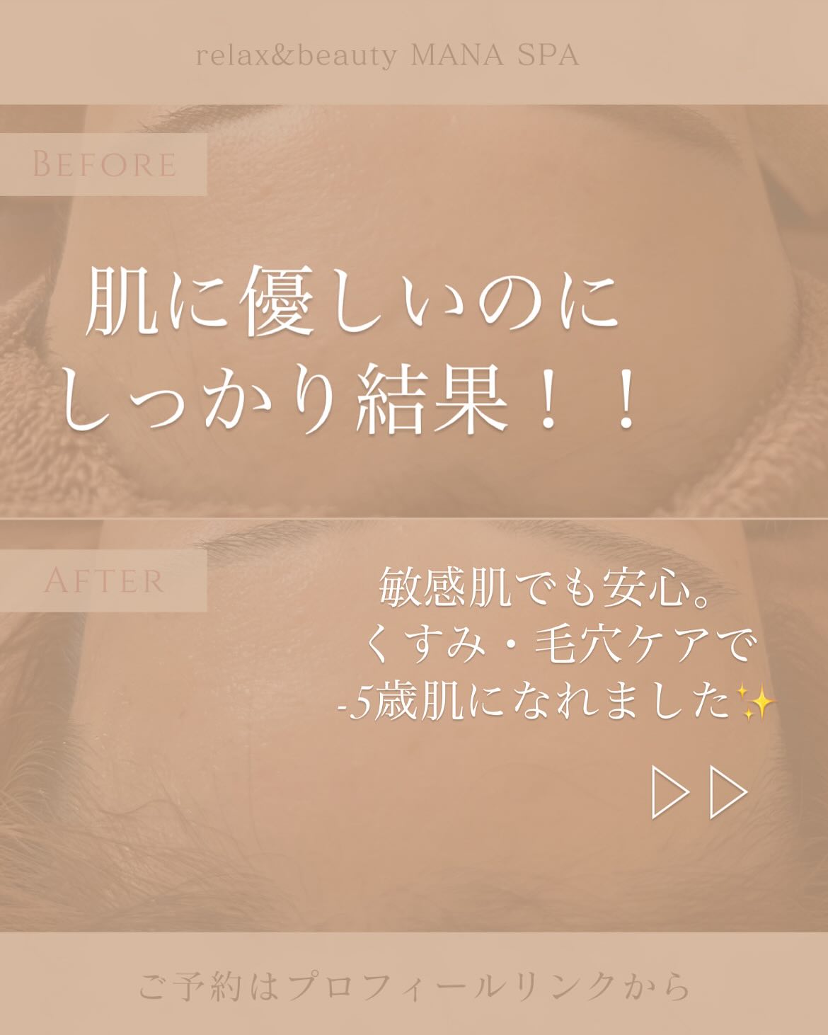 出張マッサージ